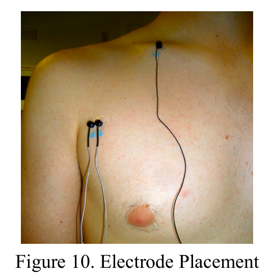 大胸筋の筋電図分析の写真